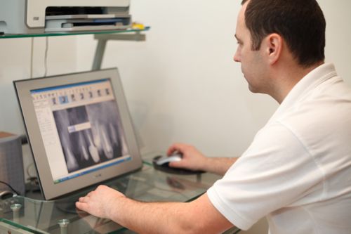 эндодонтическое лечение зубов, стоматологическая клиника в Киеве